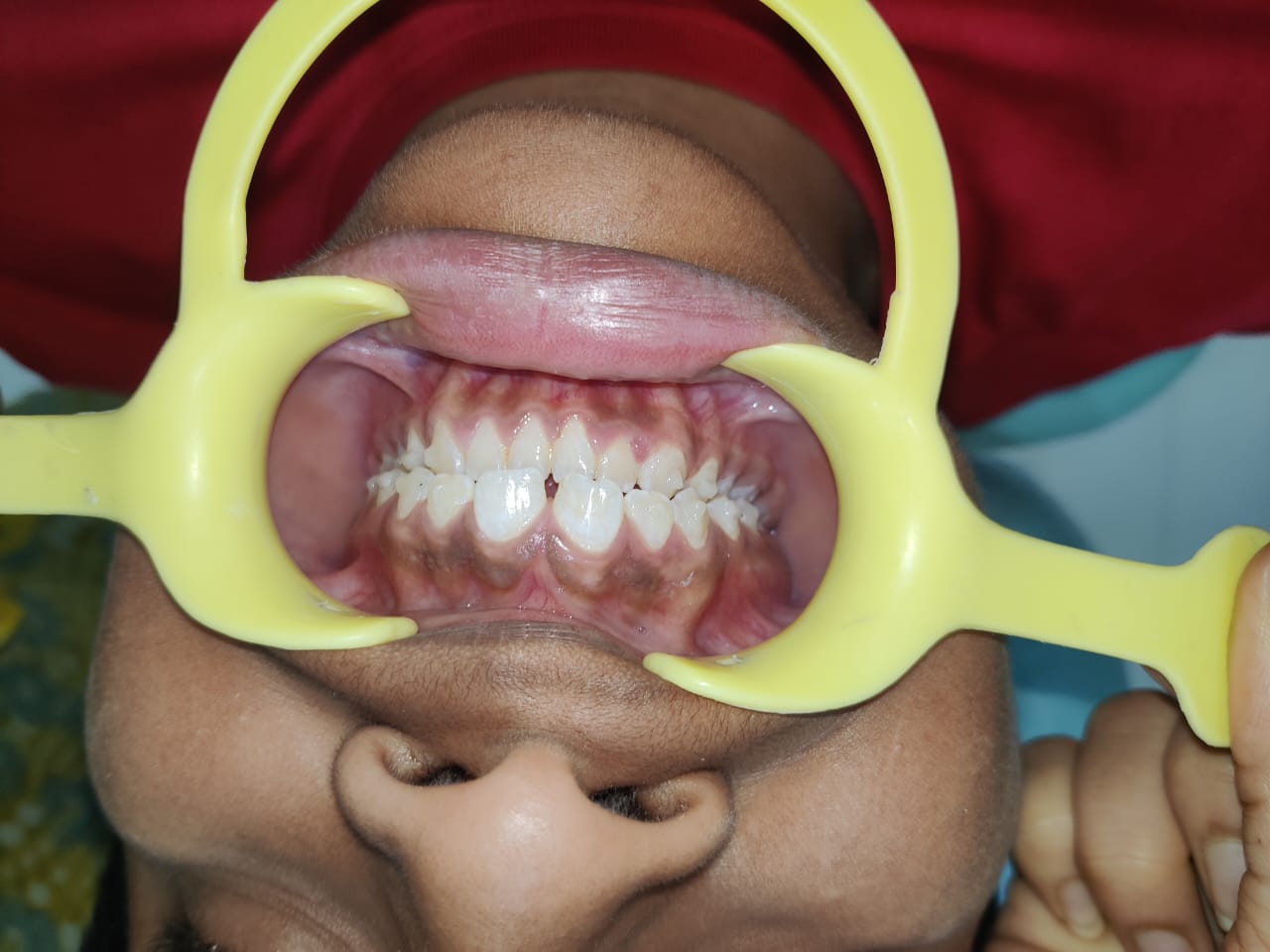 Orthodontic Assessment