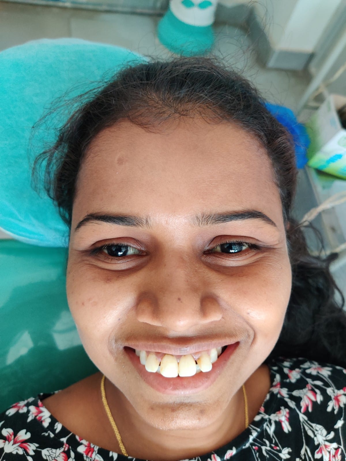 Confident Smile Restored