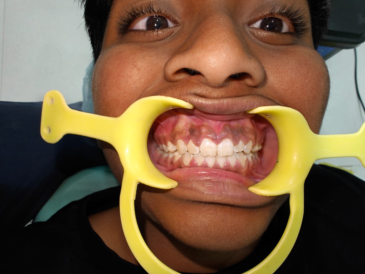 Orthodontic Case Evaluation