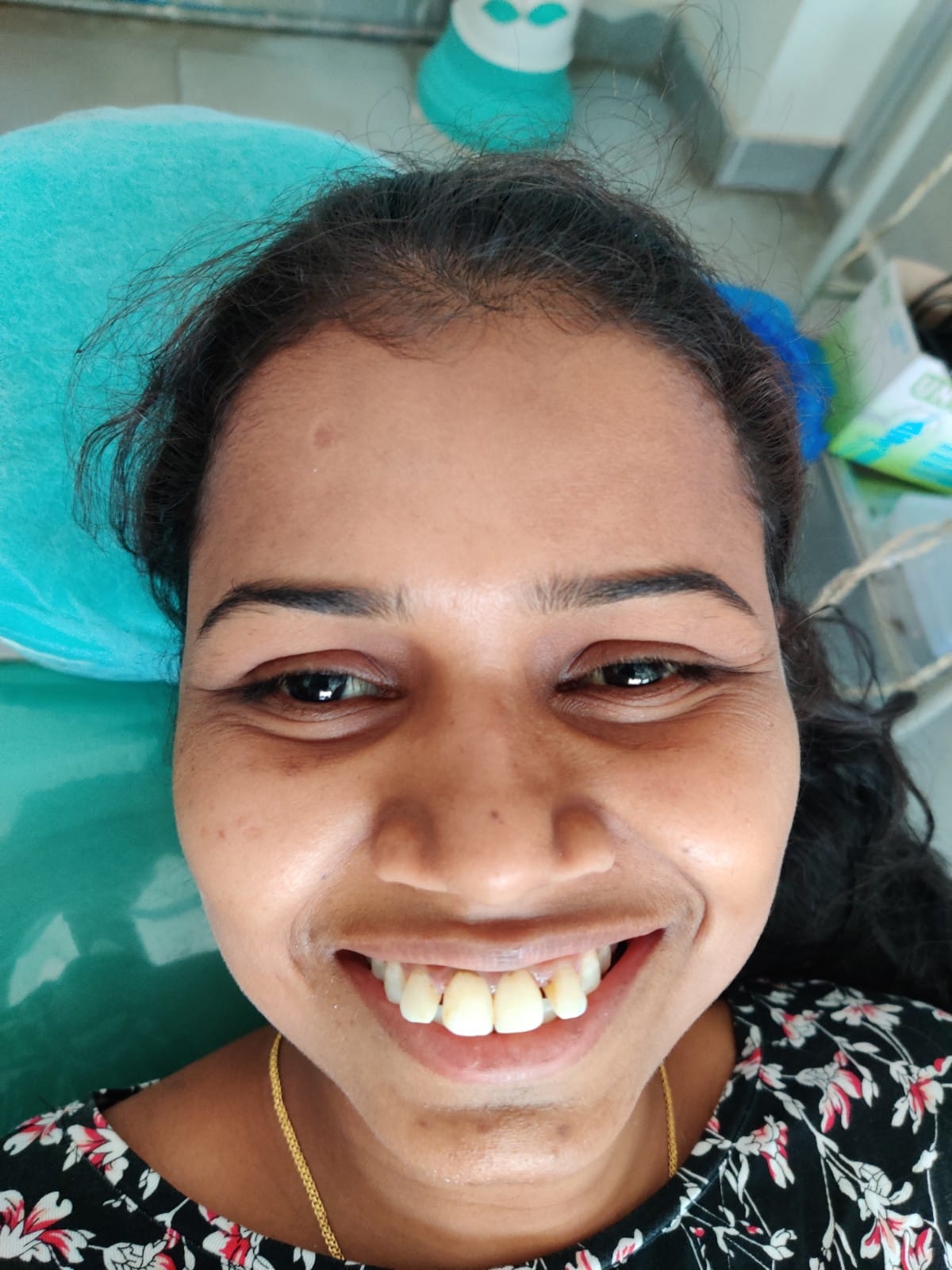 Patient Recovery — Beautiful Smile