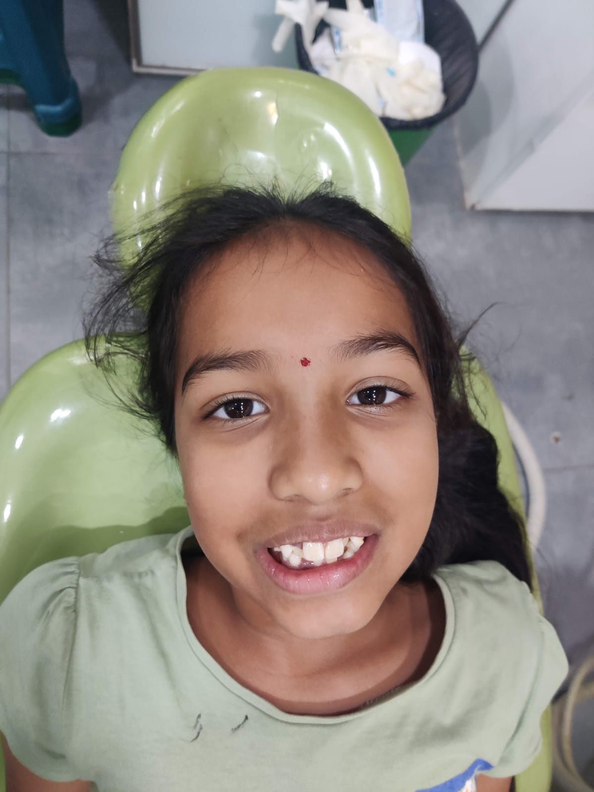 Child — Smiling After Treatment
